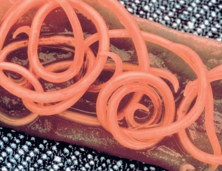 Bandwürmer aus dem menschlichen Körper