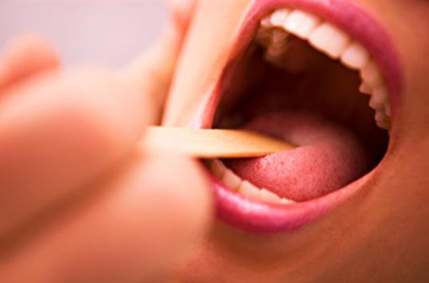 Arten von Parasiten im menschlichen Mund