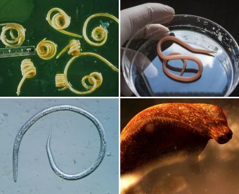Arten von Würmern im menschlichen Körper